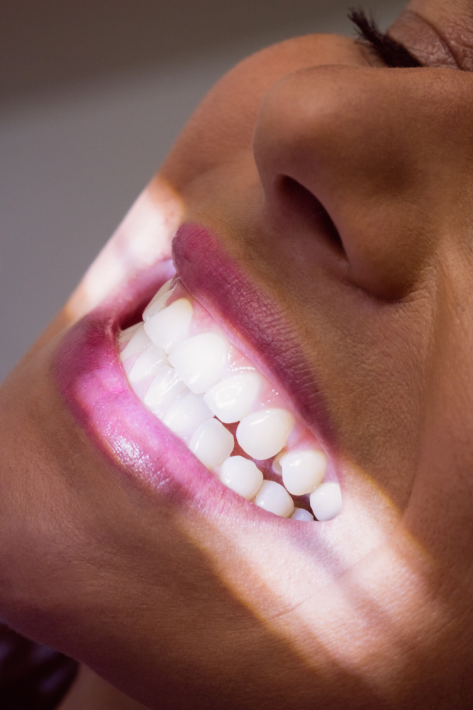 Cosmetic Teeth Whitening