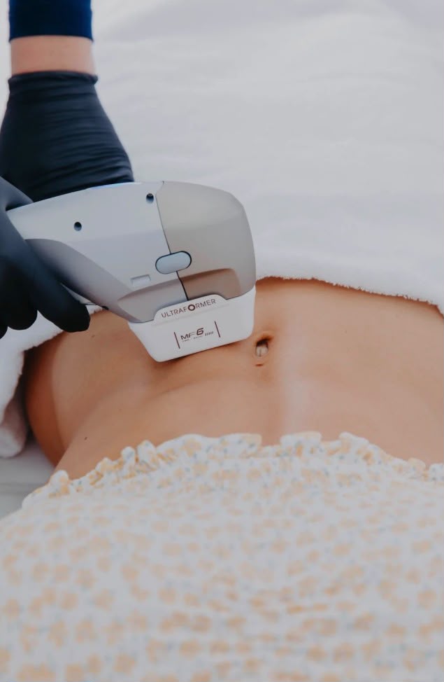 Skin Tightening