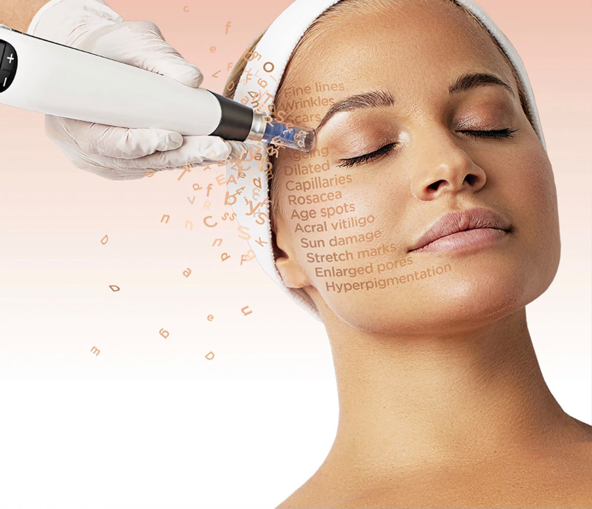 Skin Needling